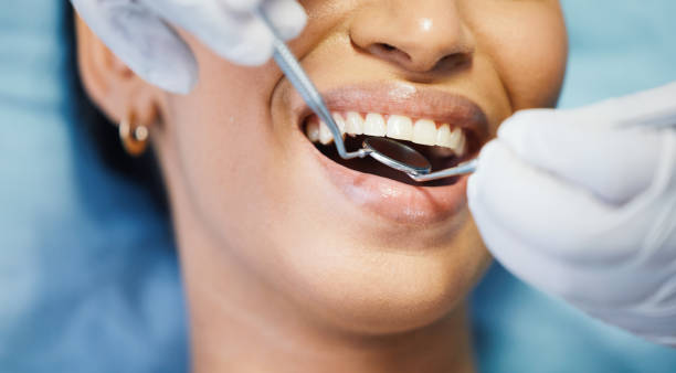 Best Tooth Infection Emergency Dentist  in Mitchell, SD